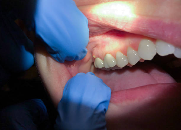 Best Emergency Tooth Extraction  in Logan, IA